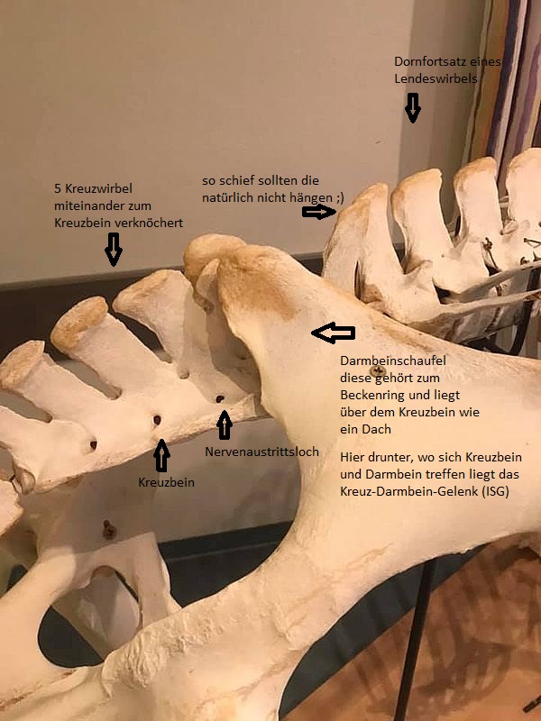 Wirbelsäule Übergang Lendenwirbelsäule zu Kreuzbein